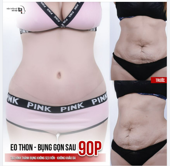 90P EO THON - BỤNG GỌN SAU 90