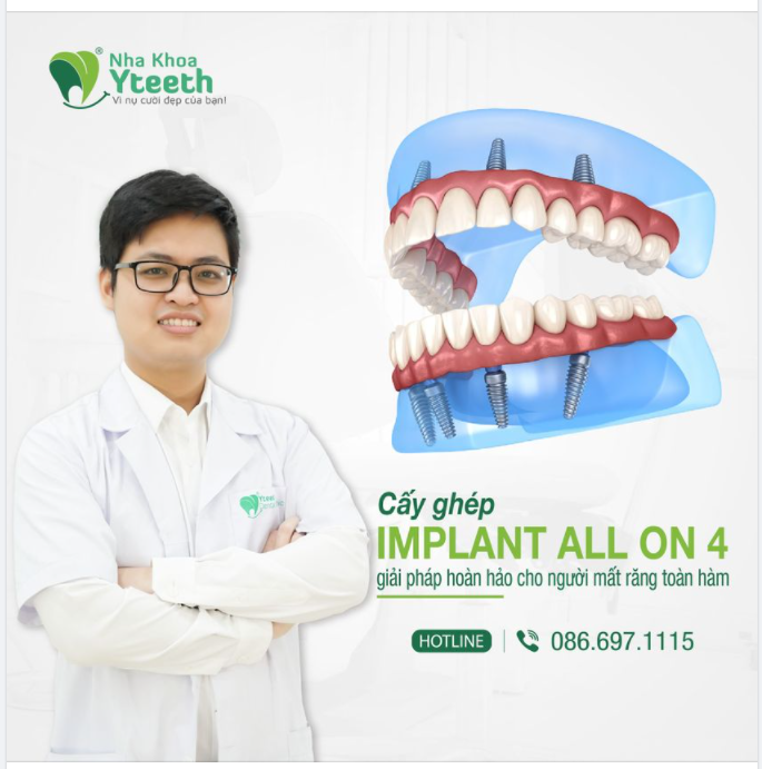 ALL ON 4 - GIẢI PHÁP CHO NGƯỜI MẤT RĂNG TOÀN HÀM!