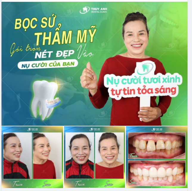 ĂN CHO MÌNH – MẶC CHO NGƯỜI