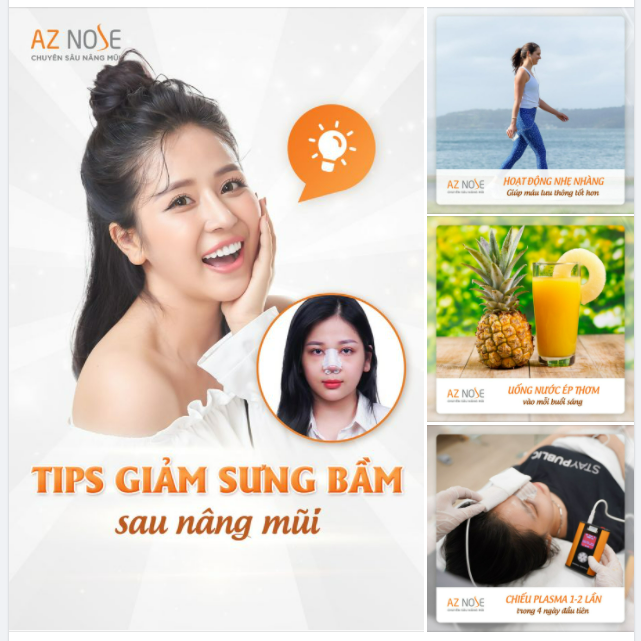 Áp dụng 3 tips sau để mũi giảm s.ưng bầ.m hiệu quả