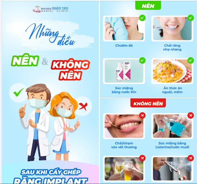 Bạn đã biết nên làm gì sau khi cấy ghép răng implant thành công chưa?