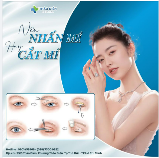 Bạn muốn có một đôi mắt đẹp, 2 mí to tròn đều,thu hút mọi ánh nhìn