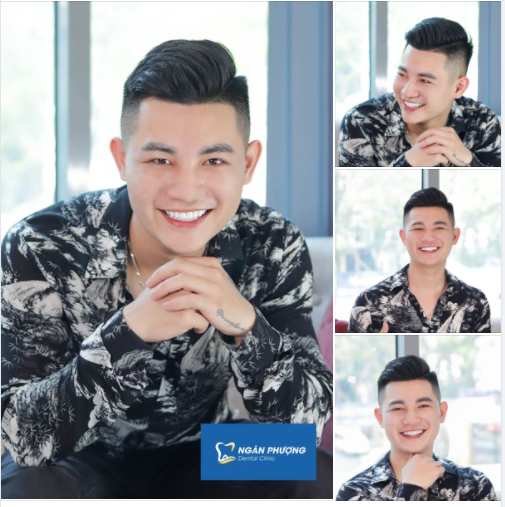 Bật phong độ lịch lãm với nụ cười tự tin tỏa sáng
