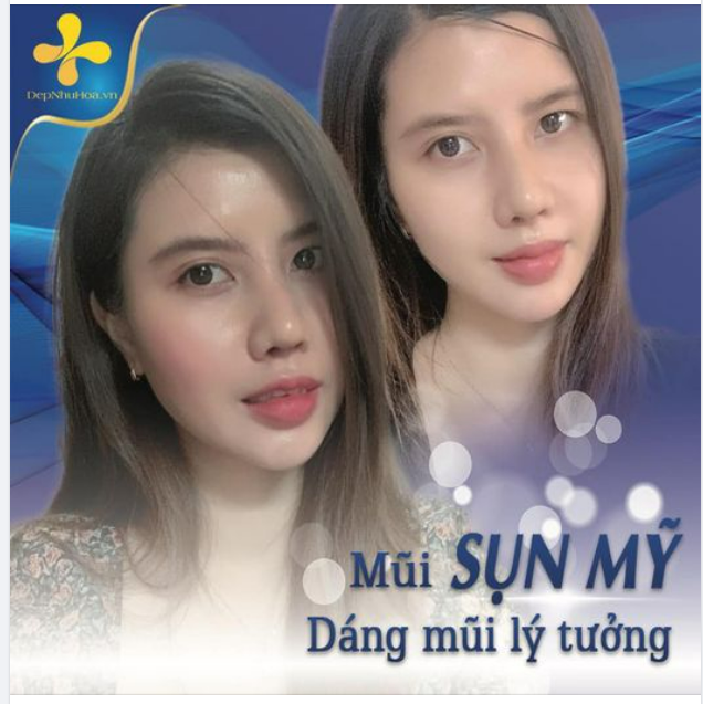 BÍ ẨN PHÍA SAU SỰ THU HÚT CỦA DÁNG MŨI ĐẸP