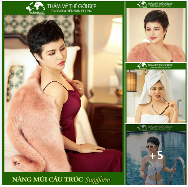 Bí mật được bật mí từ giải pháp Nâng mũi cấu trúc bằng sụn tự thân kết hợp Surgiform.