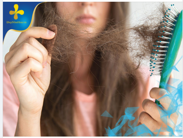 BỊ RỤNG TÓC NẾU ĐIỀU TRỊ BẰNG THUỐC KHÔNG HIỆU QUẢ, BẠN HÃY THỬ PHƯƠNG PHÁP NÀY!