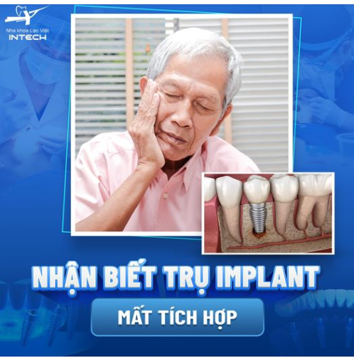 BIỂU HIỆN TRỤ IMPLANT BỊ ĐÀO THẢI LÀ GÌ