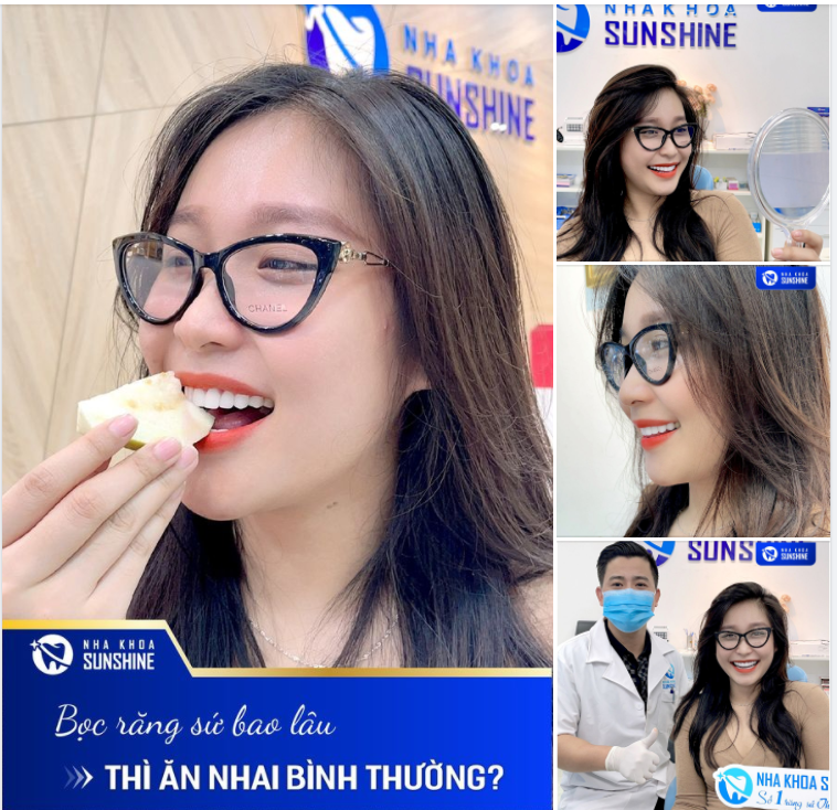 BỌC RĂNG SỨ BAO LÂU THÌ ĂN NHAI BÌNH THƯỜNG?