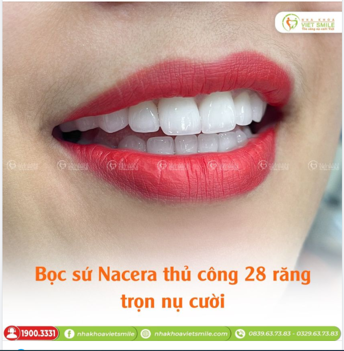BỌC SỨ NACERA THỦ CÔNG 28 RĂNG TRỌN NỤ CƯỜI