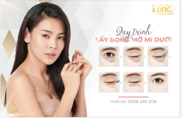 BỌNG MỠ ĐI XA TRẢ LẠI ÁNH MẮT TRẺ ĐẸP KIÊU SA