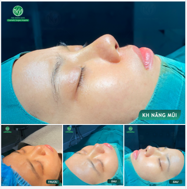 CA MŨI THỨ 4 CHO NGÀY LỄ