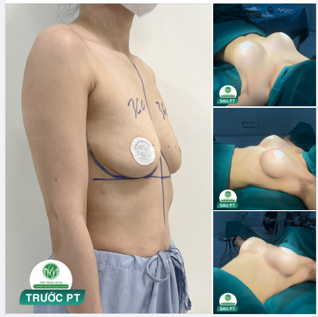CA NGỰC MỚI NHẤT CHO KH THÍCH SỰ GỢI CẢM