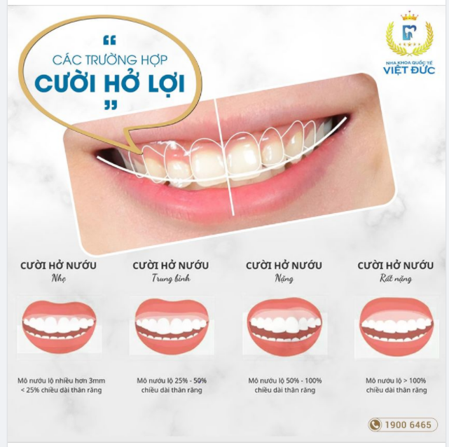CÁC TRƯỜNG HỢP CƯỜI HỞ LỢI