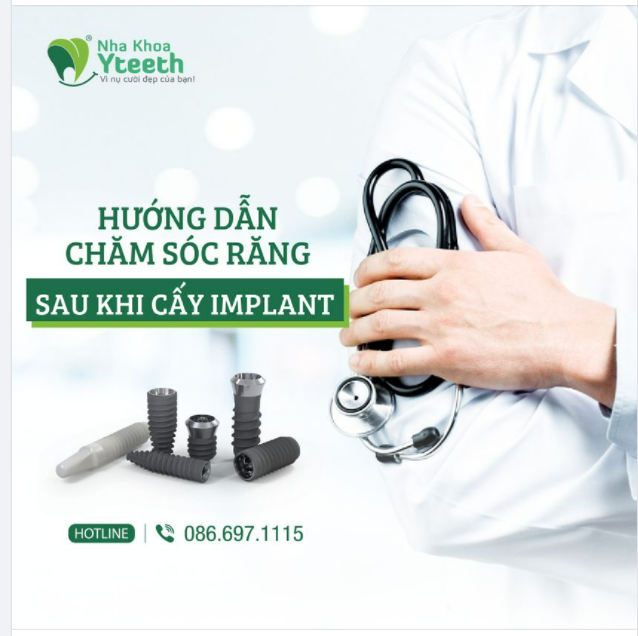 CÁCH CHĂM SÓC RĂNG SAU KHI CẤY GHÉP IMPLANT