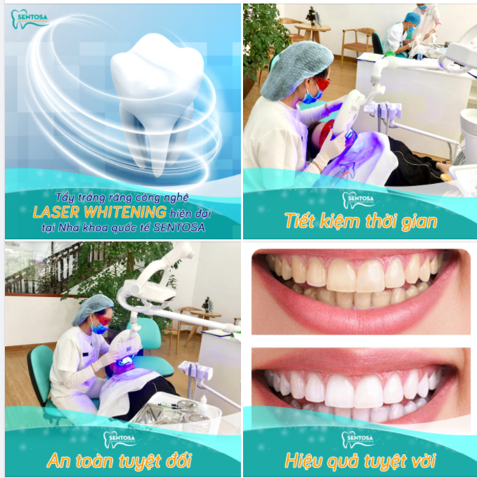 "Cái răng cái tóc là góc con người - Book lịch tẩy trắng nụ cười đẹp tươi