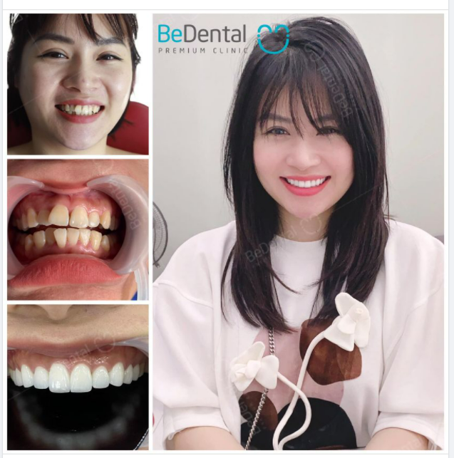 Cái răng cái tóc là góc con người Thay răng, đổi kiểu tóc mới là như một con người khác luôn