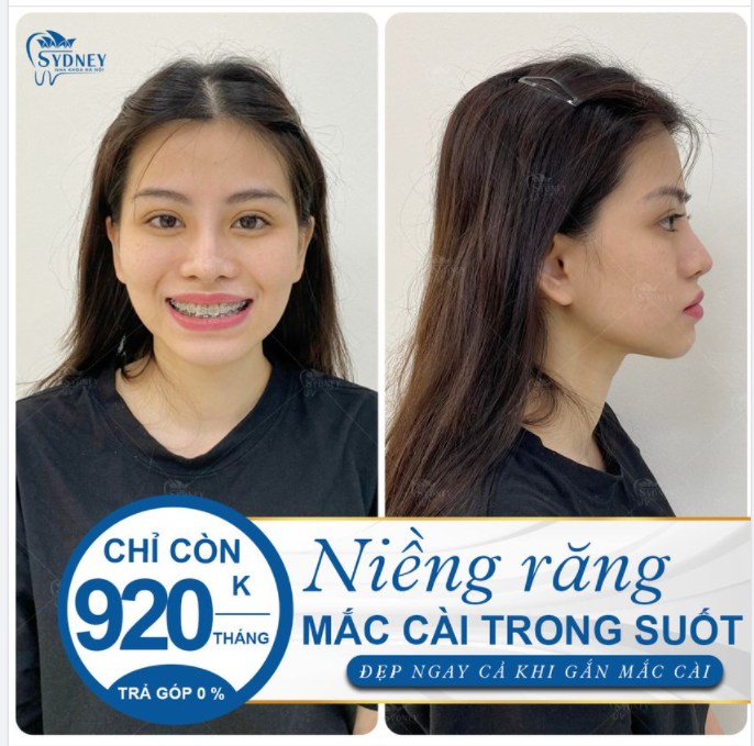 CẢI THIỆN GÓC NGHIÊNG HIỆU QUẢ