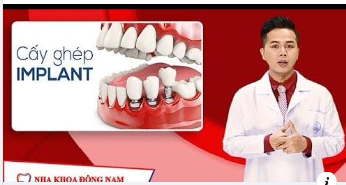 Cảm giác lo lắng trước khi cấy ghép Implant thường xuất phát từ việc chúng ta chưa hiểu rõ tường tận các vấn đề về phương pháp này.