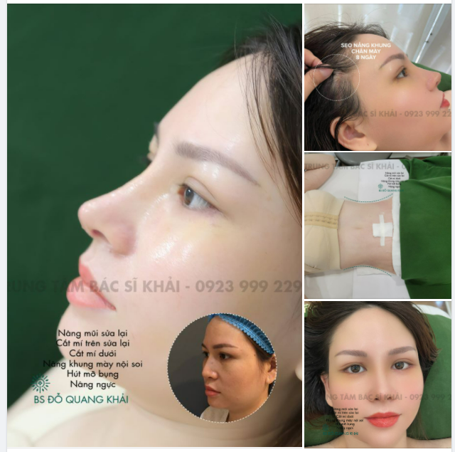 CẬN CẢNH KẾT QUẢ SAU 8 NGÀY CỦA COMBO 6 DỊCH VỤ