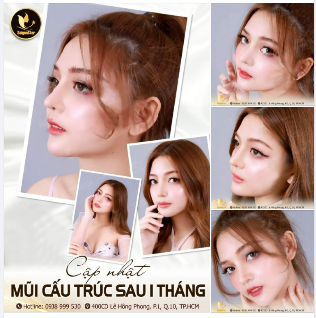 CẬP NHẬT MŨI CẤU TRÚC SAU 1 THÁNG