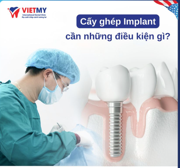 CẤY GHÉP IMPLANT CẦN NHỮNG ĐIỀU KIỆN NÀO