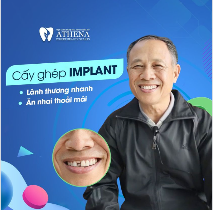 CẤY GHÉP IMPLANT - LÀNH THƯƠNG NHANH, ĂN NHAI THOẢI MÁI