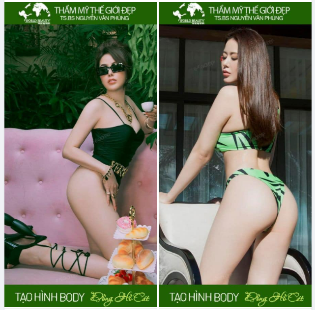 Cấy mỡ tự thân - tạo hình vòng 3 nở nang , căng tròn - Sở hữu ngay Body  Đồng hồ cát