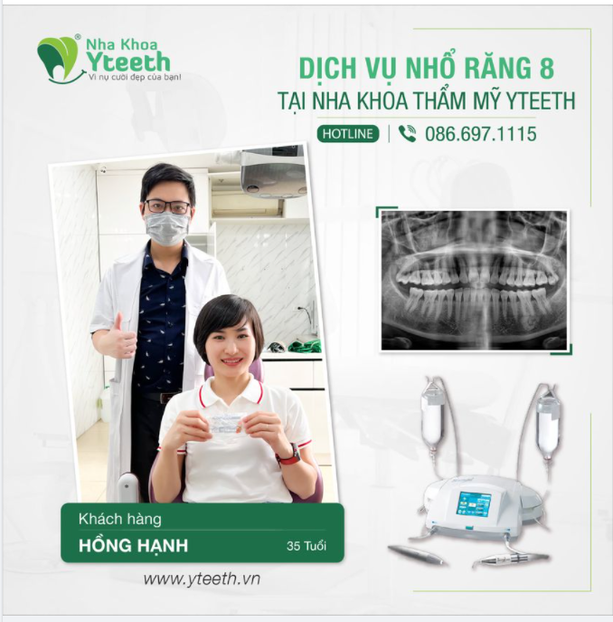 Chị Hồng Hạnh 35 tuổi nhổ 2 răng số 8 chỉ sau 10 phút cho cả 2 chiếc răng.