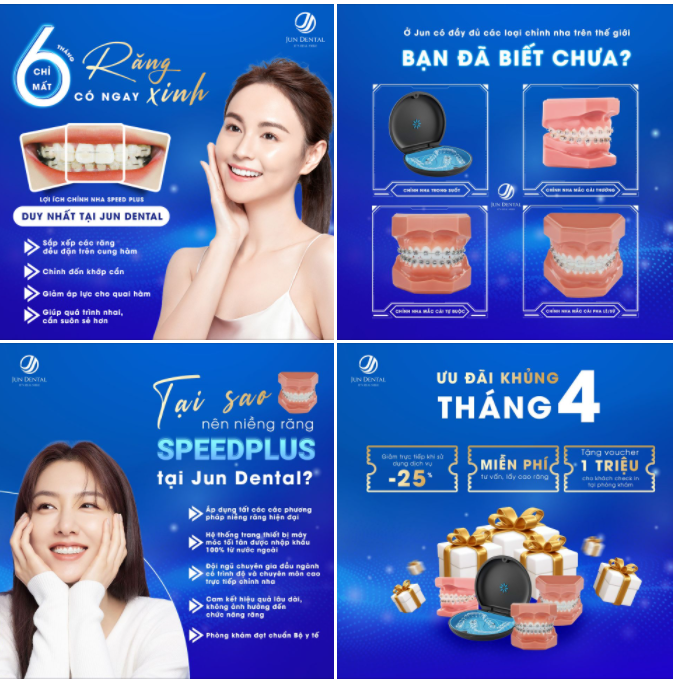 CHỈ MẤT 6 THÁNG CÓ NGAY RĂNG XINH