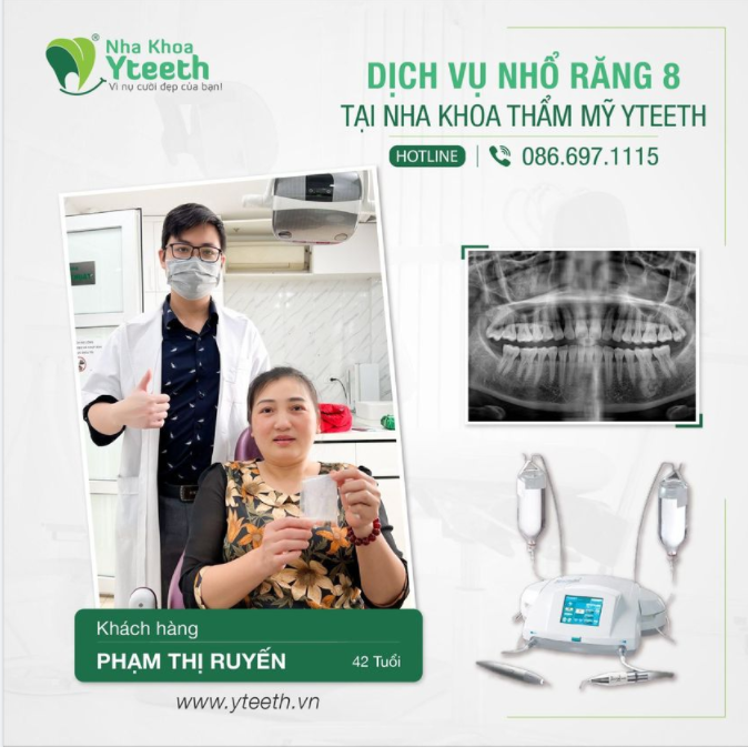 Chị Phạm Thị Ruyến 42 tuổi nhổ 2 răng số 8 chỉ sau 10 phút cho cả 2 chiếc răng.