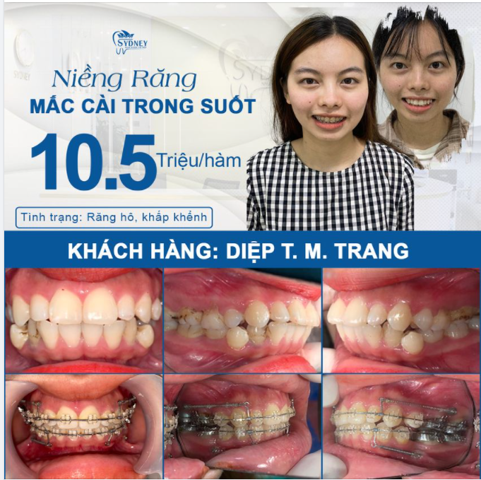 CHI PHÍ THẤP - HIỆU QUẢ CAO