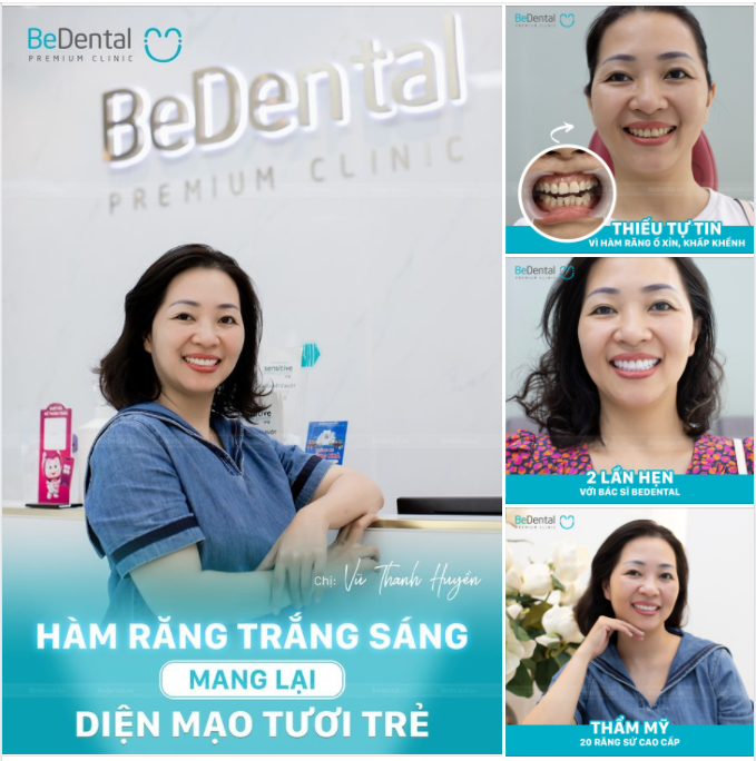 Chị Vũ Thanh Huyền tự tin trong diện mạo trẻ đẹp sau thẩm mỹ răng sứ tại Bedental