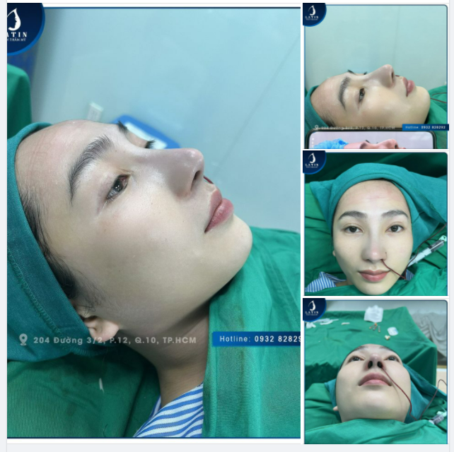 CHIA TAY MŨI THẤP, TẸT LÊN ĐỜI MŨI CAO XINH!