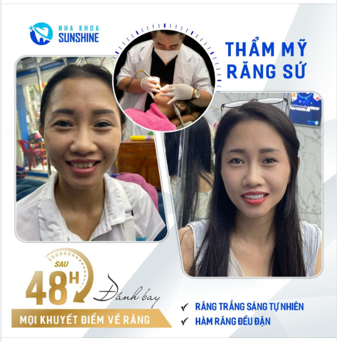 CHINH PHỤC NỤ CƯỜI RẠNG RỠ ĐÓN HÈ CÙNG SUNSHINE