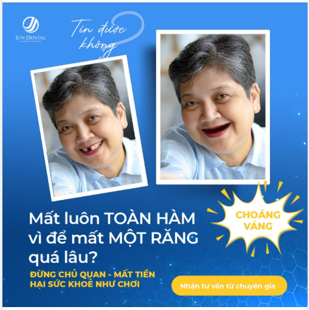 CHOÁNG VÁNG VÌ MẤT LUÔN TOÀN HÀM VÌ ĐỂ MẤT MỘT RĂNG QUÁ LÂU TIN ĐƯỢC KHÔNG