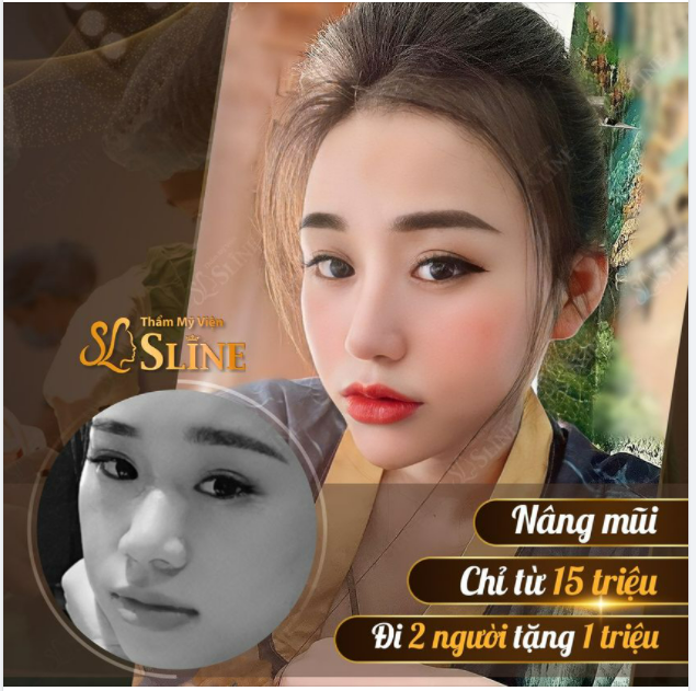 Cô ấy...! Thay đổi hẳn khuôn mặt nhờ dịch vụ nâng mũi tại Thẩm Mỹ Viện Sline là bộ phận quyết định đến 80% nhan sắc của phụ nữ, vì thế một chiếc mũi cao, thanh thoát sẽ giúp gương mặt trở nên xinh đẹp và ấn tượng hơn.