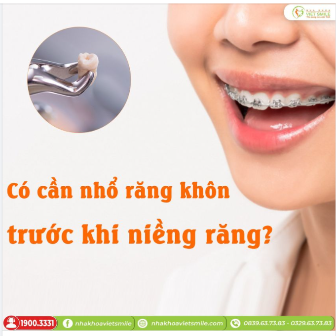 CÓ CẦN NHỔ RĂNG KHÔN TRƯỚC KHI NIỀNG RĂNG