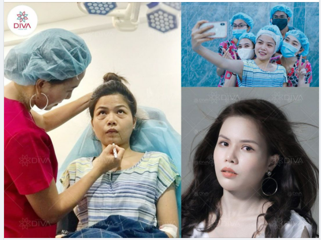 CÔ GÁI THOÁT MÁC “BÀ GIÀ TUỔI 22” SAU THẨM MỸ TẠI DIVA