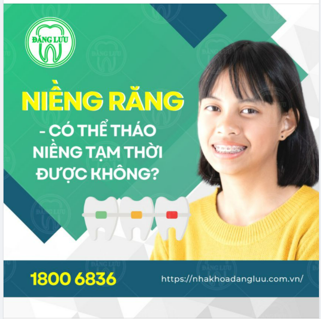 Có thể bạn thắc mắc Niềng răng – có thể tháo niềng được không