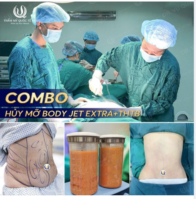 Combo Hủy mỡ bụng ​​​​​​​ Tạo hình thành bụng Xóa sổ bụng  Xồ Xề  sau sinh