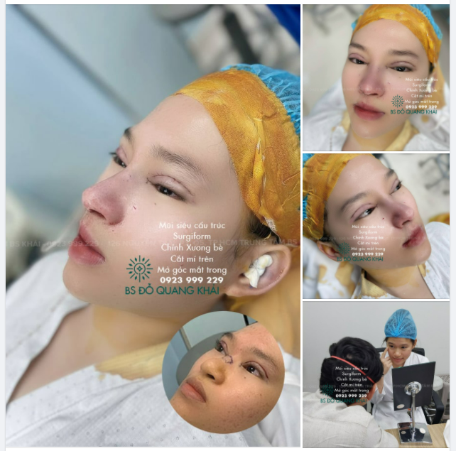COMBO MŨI, MÍ TỰ SIÊU XINH CHO BẠN KHÁCH ĐÁNG YÊU