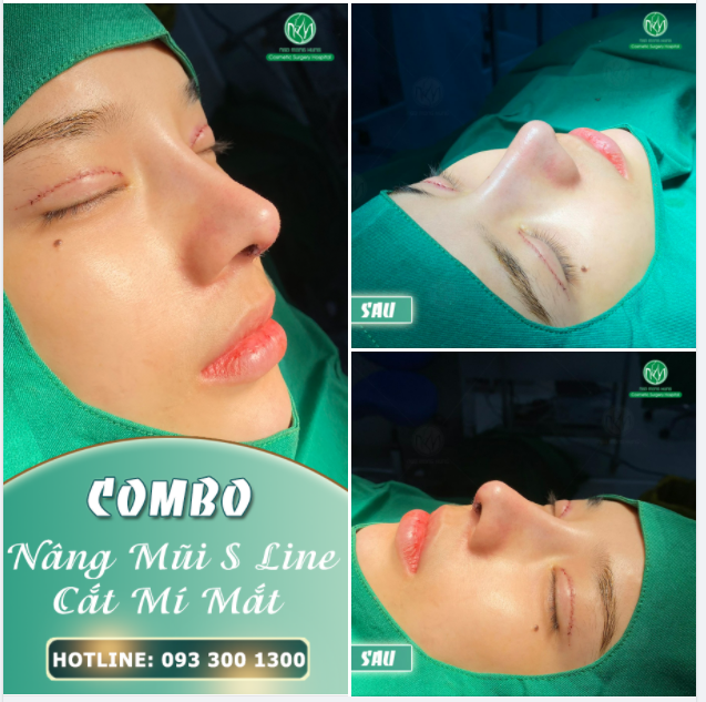COMBO TRẺ HÓA KHUÔN MẶT TOÀN DIỆN