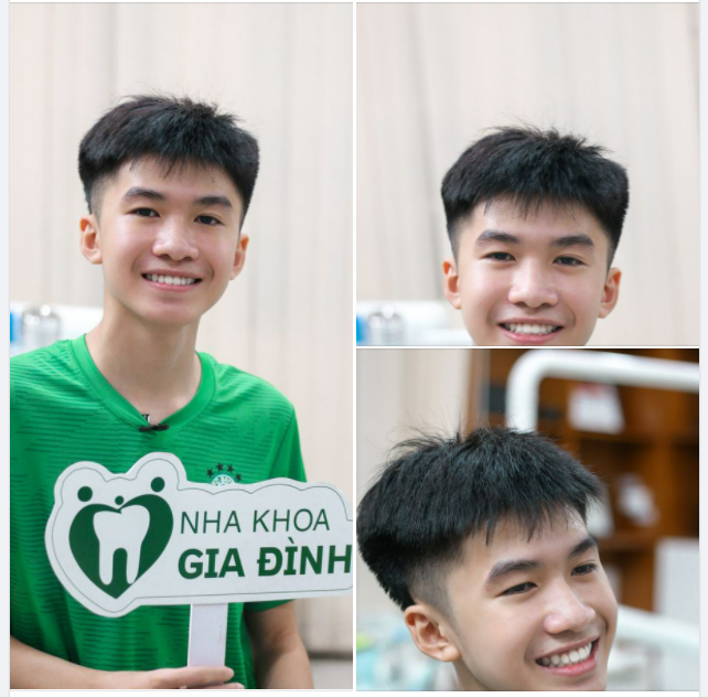 CON TRAI KHI NIỀNG RĂNG XONG CŨNG SẼ ĐẸP NHƯ THẾ NÀY ĐÂY!!!!