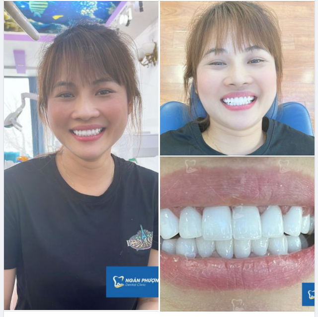Công nghệ tiên tiến – Khoẻ đẹp song hành