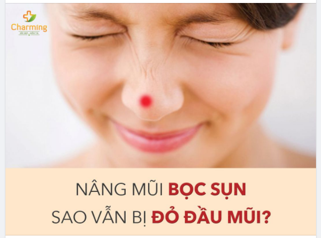 CÙNG CHARMING TÌM HIỂU THỰC HƯ TÌNH TRẠNG BÓNG ĐỎ ĐẦU MŨI SAU KHI NÂNG MŨI LÓT SỤN