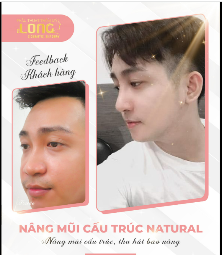 Cuộc sống của anh chàng này đã thay đổi như thế nào sau khi NÂNG MŨI