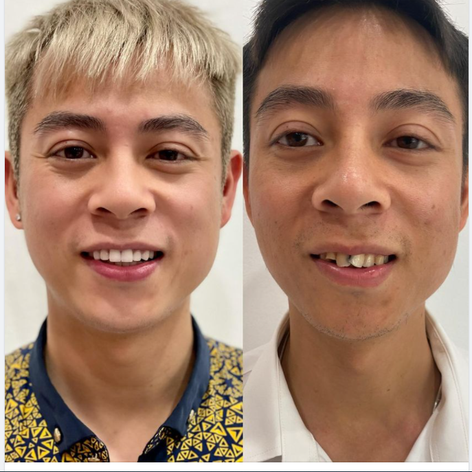 Cuộc sống không cần quá cầu kỳ nhưng nhất định phải yêu chính bản thân mình nhé!!