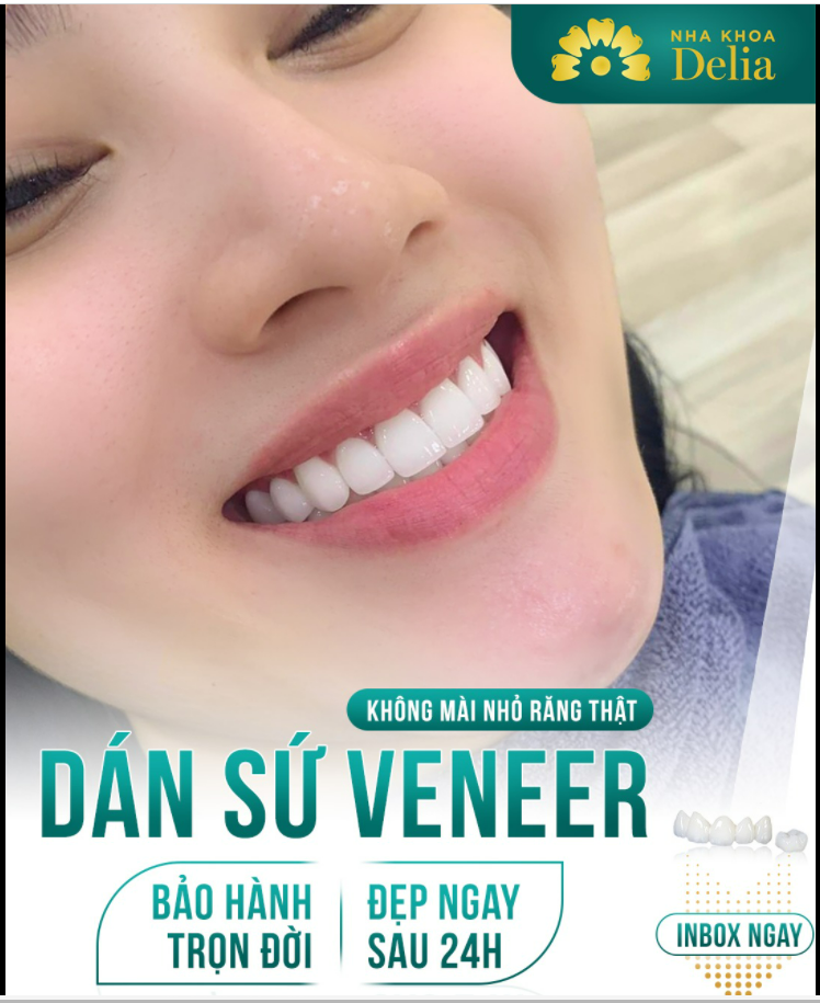 DÁN SỨ VENEER - Không mài nhỏ, bảo tồn răng gốc tối đa