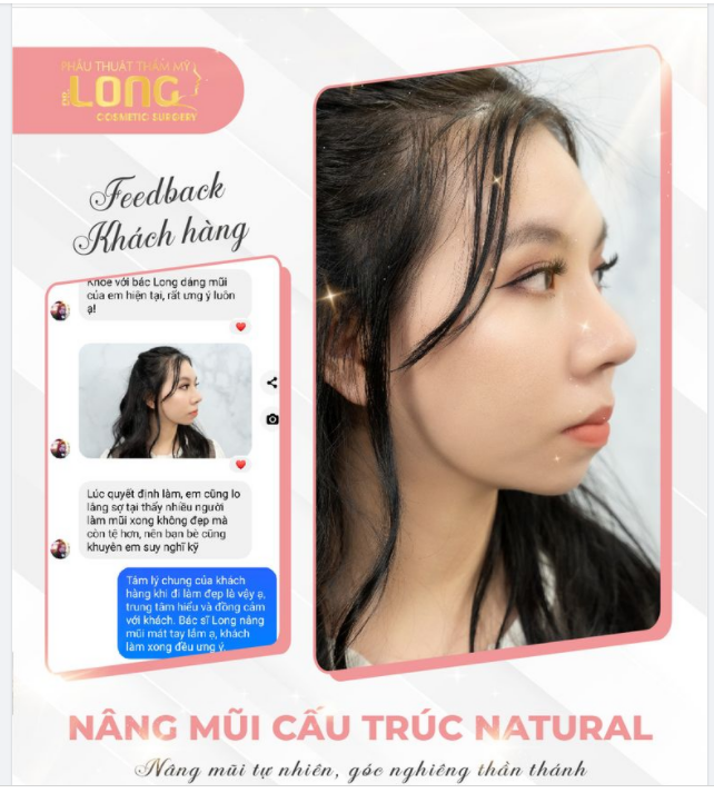DÁNG MŨI CAO SANG CHUẨN TỈ LỆ VÀNG