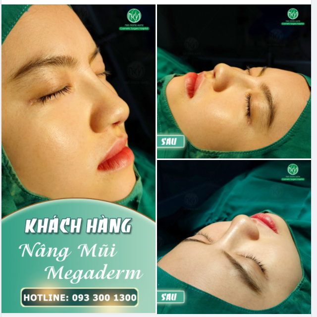 DÁNG MŨI ĐẸP CHO NGÀY MỚI